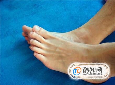 什么方法可以有效治疗脚气脚痒之白醋泡脚