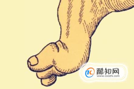 拇指外翻的危害有哪些？该怎样预防？