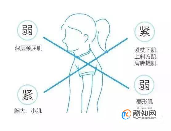 如何矫正颈椎曲度 脖子前倾