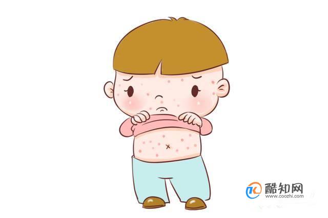 湿疹和痱子有相似处，夏季如何区分湿疹和热痱？