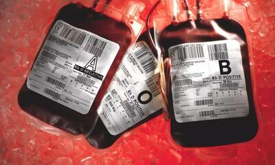 血浆和血液的区别是什么？